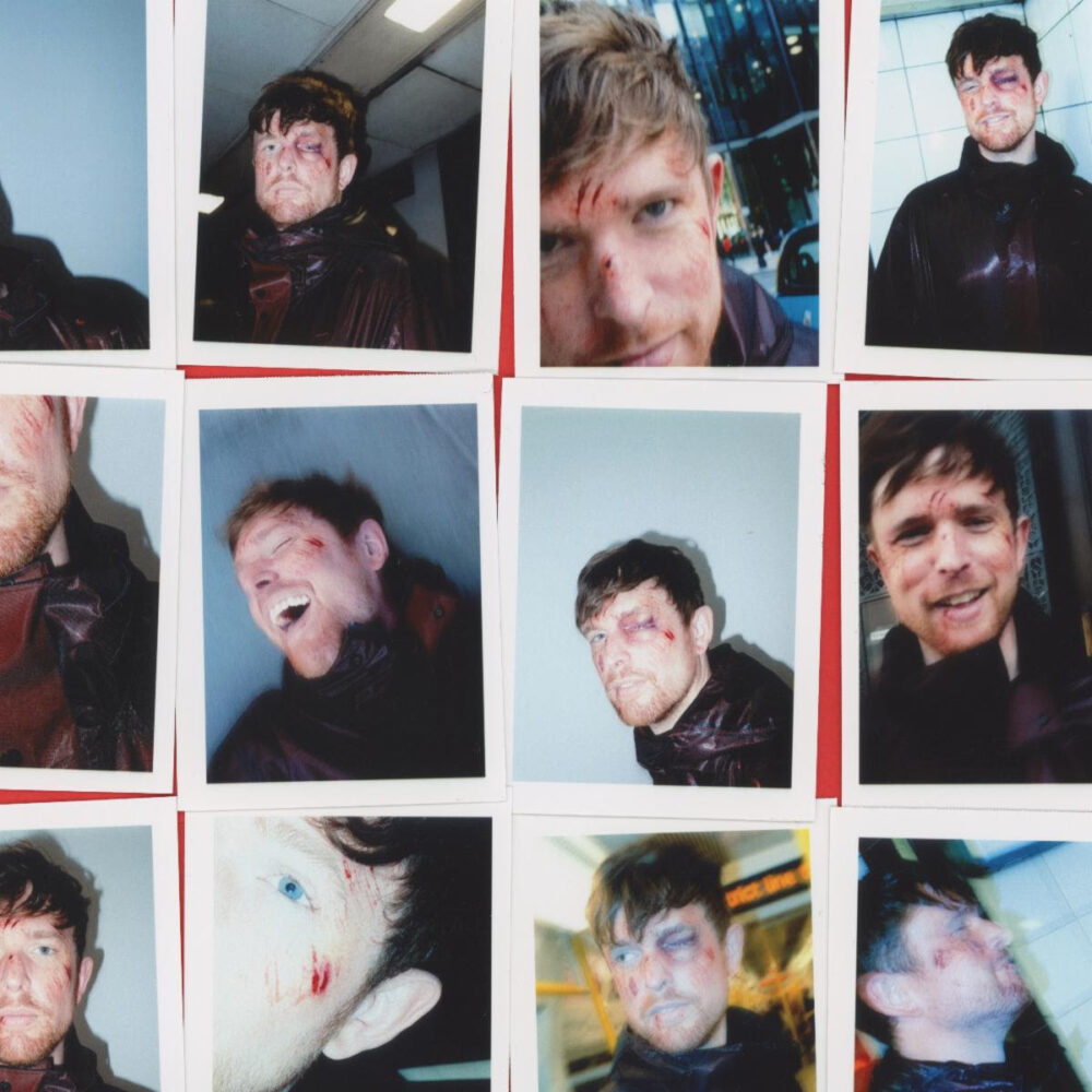 James Blake, Messie underground